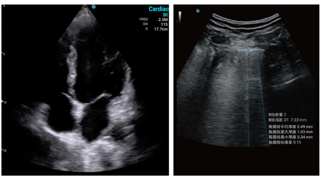 SonoEye故事：一场“了然于胸”的战“役”