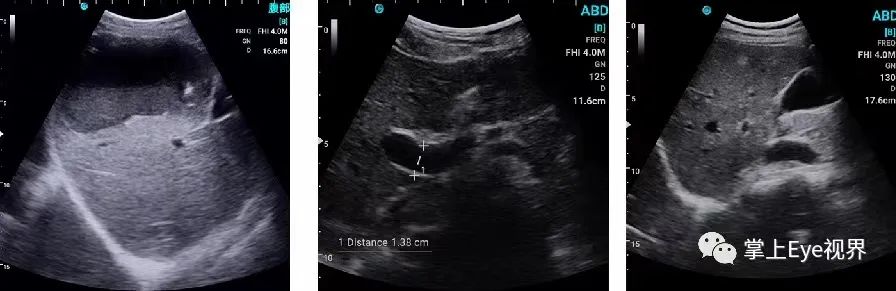 院前急救，掌超近身护航！