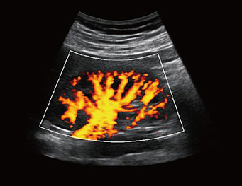 肾脏，PD 模式