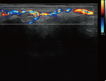 指尖血流，C 模式